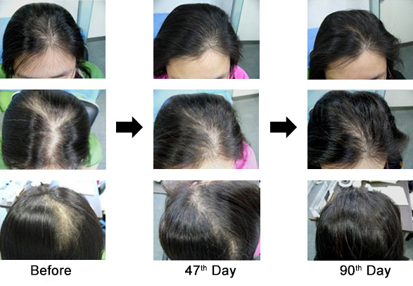 Case 1. 32-year-old Woman