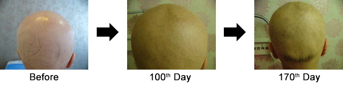 Case 2. 23-year-old Woman