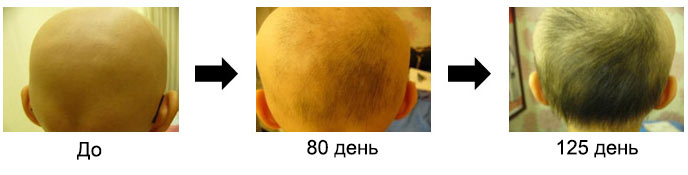 Case 3. 15-year-old Man