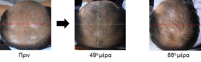 Περίπτωση 4. Άνδρας 47 ετών