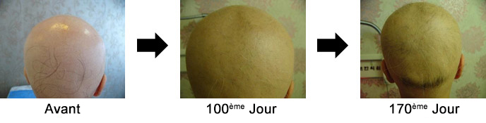 Cas 3. Homme de15 ans